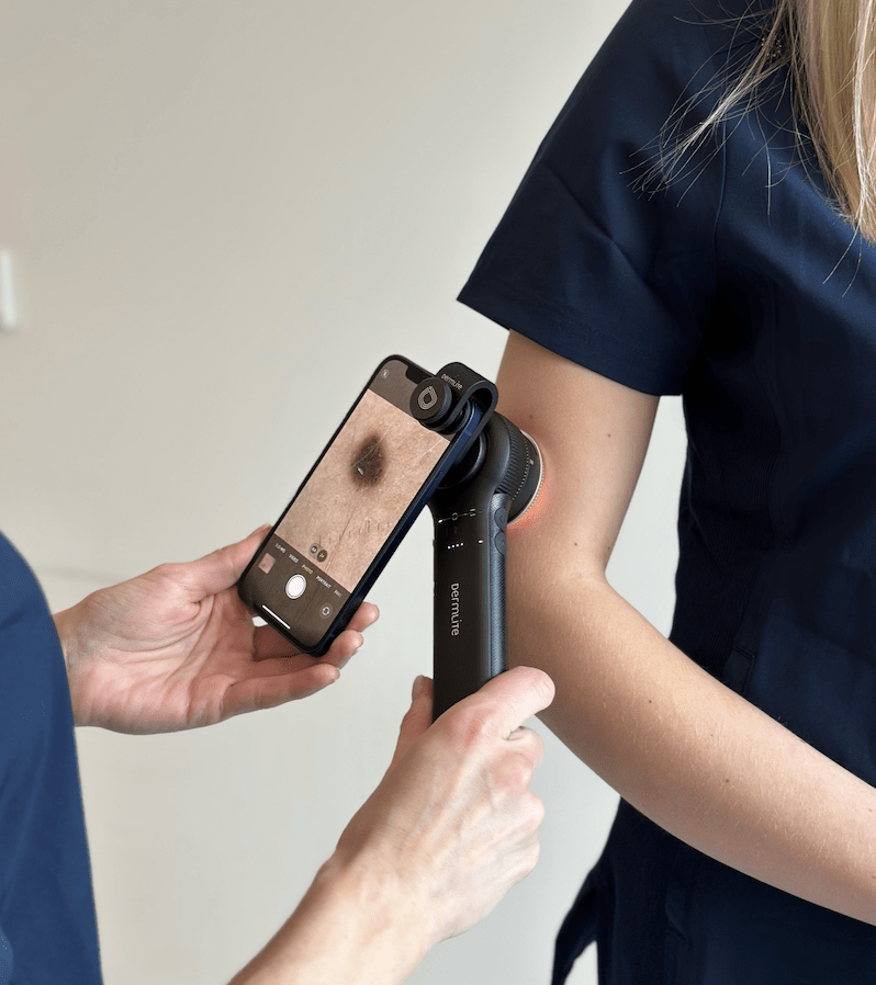 Mis vahe on dermatoveneroloogil ehk nahaarstil ja dermatoskopistil?